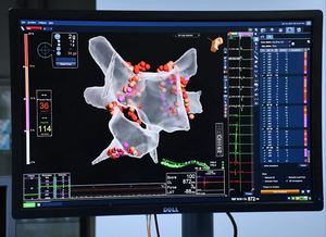 Equipo de Electrofisiología de Moderno- MCA, introducen en RD  el uso del Ecocardiograma intracardíaco