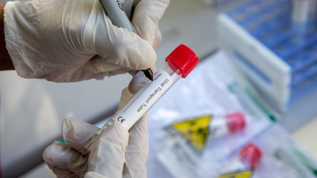 República Dominicana suma otros 1,364 casos de coronavirus