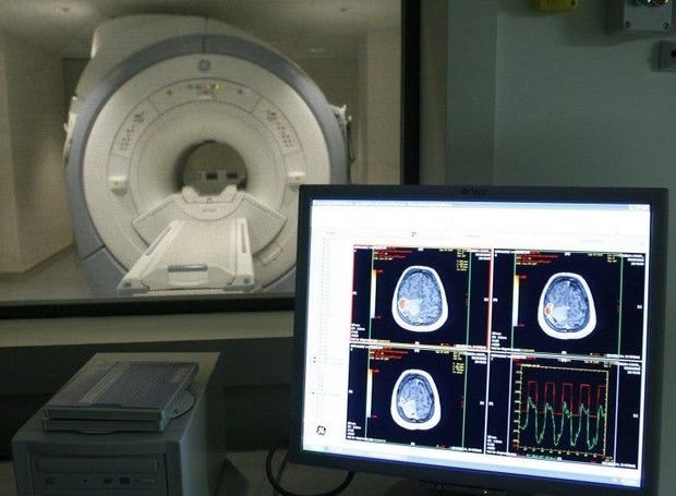Vista de una sala de escáner del Centro Alzheimer de Vallecas.