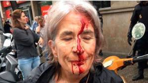 La ONU pide una investigación "independiente" sobre la violencia en Cataluña
