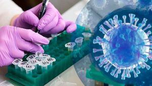 Prometedores resultados de la vacuna contra el coronavirus de la Universidad de Oxford