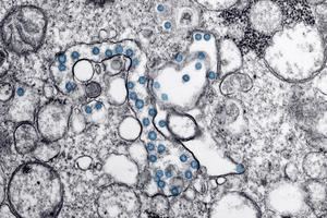 El coronavirus tiene capacidad de provocar un envejecimiento acelerado
 

 