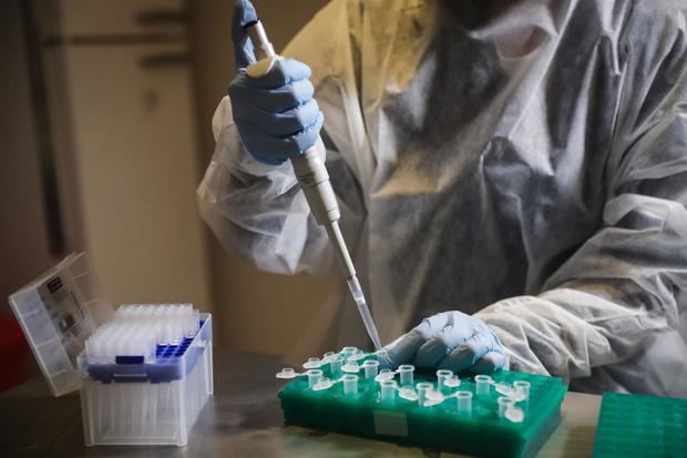 Fotografía de archivo en la que se registró el proceso de lectura de pruebas de detección de la covid-19, en un laboratorio de bioquímica, en Montevideo, Uruguay.