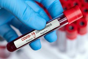 El ministro de Salud niega que se manipulen las estadísticas del coronavirus