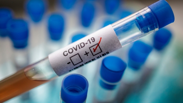 OPS donará 100 mil pruebas Covid-19.