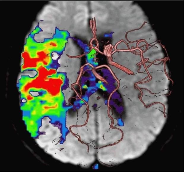 Imagen del cerebro. 