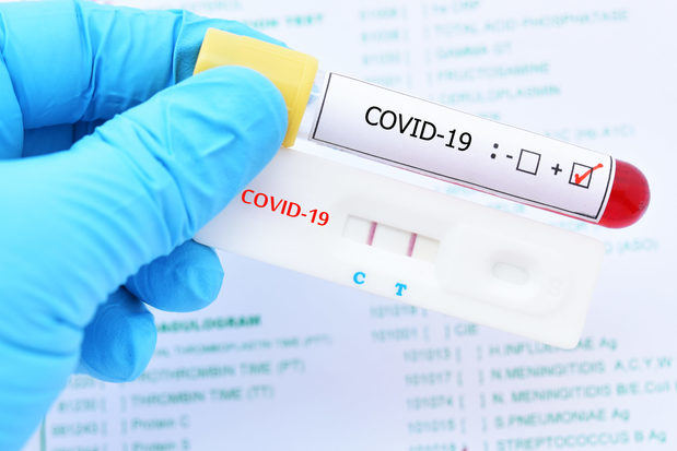 Los casos de Covid-19 en RD ya suman 166,764 tras reportarse 824 nuevos contagios.
