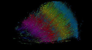 Un milímetro cúbico de cerebro humano desvela el mayor conjunto de conexiones neuronales