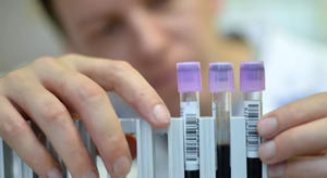 Un análisis de sangre podría predecir el párkinson siete años antes de los síntomas