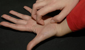 Una joven rasca la palma de su mano a causa de los picores producidos por una dermatitis.