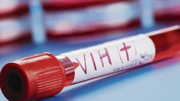 El aumento de enfermos con VIH de edad avanzada presenta un reto sanitario.