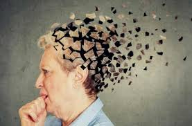Alzheimer, una de las formas de demencia más frecuentes del mundo.