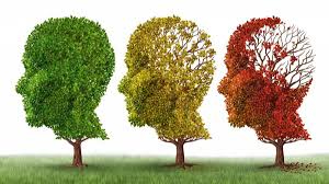 Alzheimer, una de las formas de demencia más frecuentes del mundo.