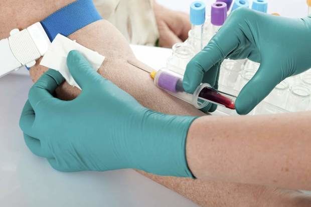 Una técnica de análisis de sangre puede ser vital para controlar infecciones.