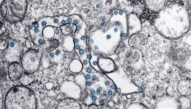 Partículas del virus SARS-CoV-2, coloreadas en azul, en una imagen de microscopio de electrones. Imagen facilitada por el Consejo Superior de Investigaciones Científicas.