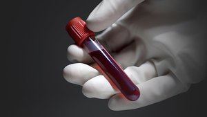 Crean un test de sangre capaz de detectar de forma temprana 8 tipos de cáncer