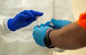 Casos de coronavirus ascienden a 47 millones, con más población joven afectada
