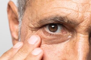 Degeneración macular relacionada a la edad, ladrón de la visión