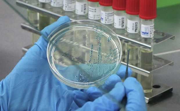 MISPAS notifica a la población seis nuevos casos de cólera