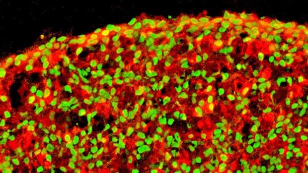 Imagen de células beta pancreáticas derivadas de células pluripotentes humanas facilitada por el investigador Juan Carlos Izpisúa, del Instituto Salk en California. En rojo: insulina / en verde: NKX6.1. Ambos son biomarcadores de las células beta pancreáticas.
