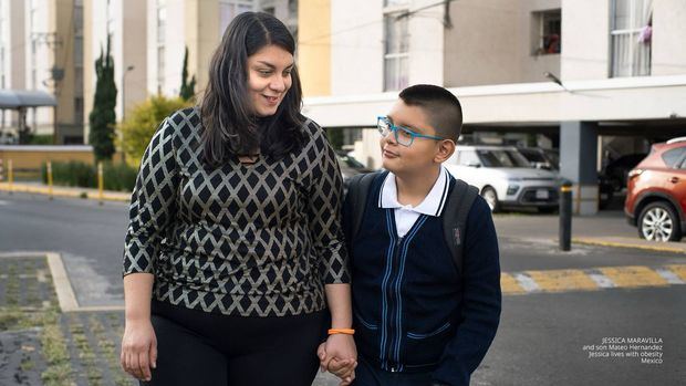 Obesidad y diabetes: riesgos cardíacos en aumento.
