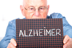 ¿Se contagia el Alzheimer? 