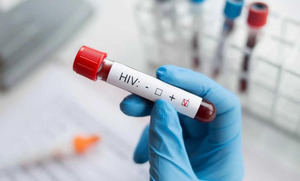 OPS aclara que no ha declarado epidemia de VIH en República Dominicana