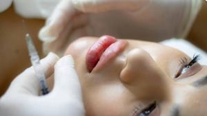 Aumento de labios: naturalidad ante todo