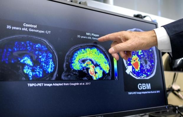 Investigadores de la Universidad Internacional de Florida que investigan el Alzhéimer.