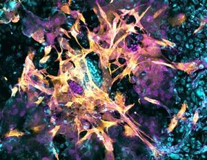 Científicos logran implantar un embrión en un endometrio artificial