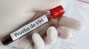 Día Mundial del Sida : m ás de la mitad de diagnósticos de VIH en Europa llegan tarde