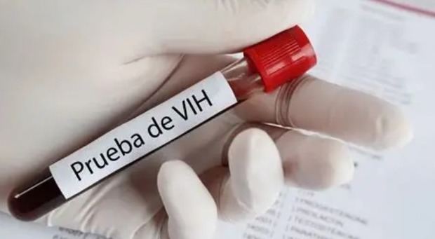 Más de la mitad de diagnósticos de VIH en Europa llegan tarde.