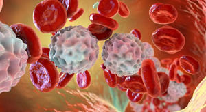 Tratamiento innovador para leucemia linfoblástica aguda en niños y adultos marca un hito en primera línea