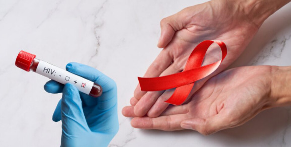 Solo un 38 % de mujeres en República Dominicana tiene conocimiento integral sobre el VIH.