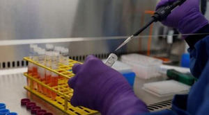 Investigadores mexicanos desarrollan tratamiento "menos invasivo" para la hipertensión