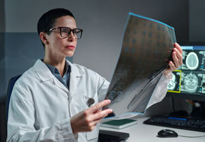 Expertos de Cleveland Clinic alertan sobre el impacto de tumores cerebrales benignos