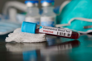 Advierten del riesgo de un rebrote de coronavirus en República Dominicana