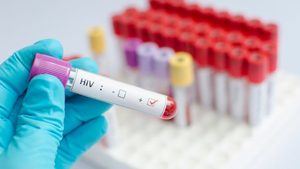 ONU: Los contagios por VIH crecieron un 7 % en Latinoamérica desde 2010
 