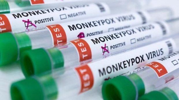 Nueva York declara el estado de emergencia por los casos de viruela del mono